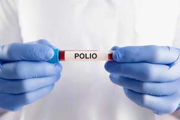 شلل الأطفال: الأسباب والمخاطر والوقاية