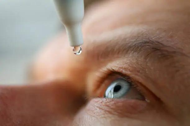 قطرة العين: أنواعها وكيفية استخدامها
